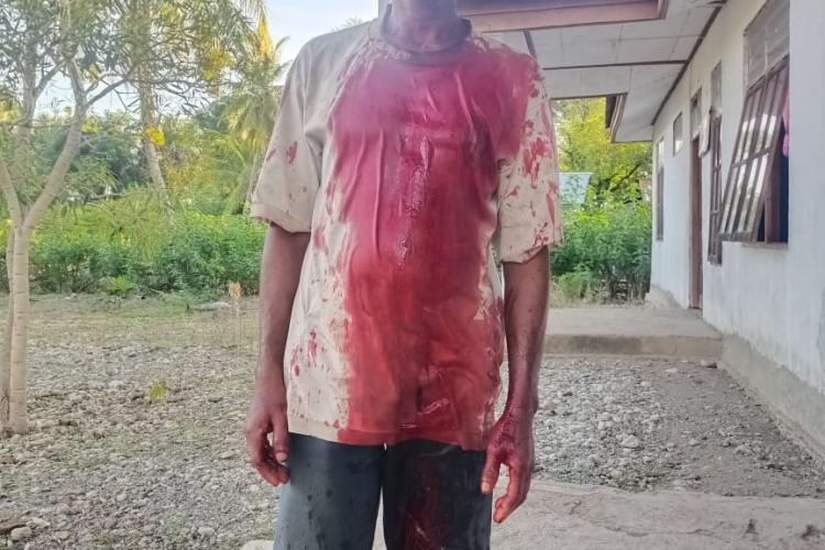 Korban Dicekik Sampai Berlumuran Darah, Penganiayaan Berat Terjadi di Tainsala, TTU